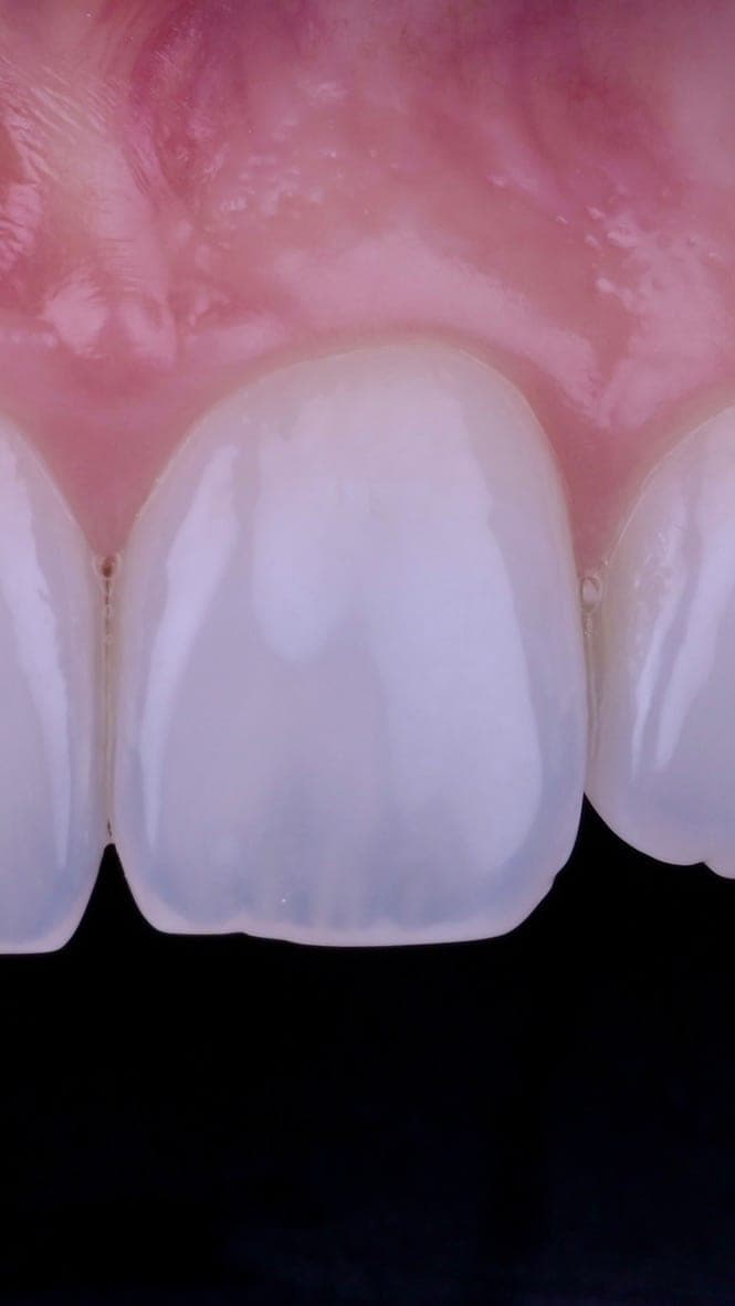 Federal-Dent — smile 1